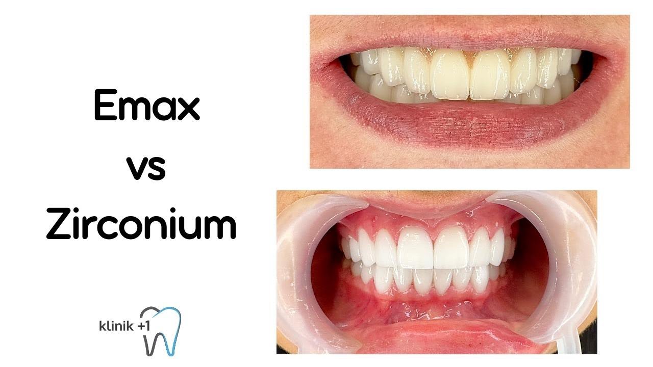 Zirconium-Emax