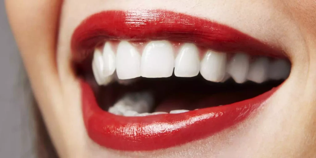 istanbul hollywood smile