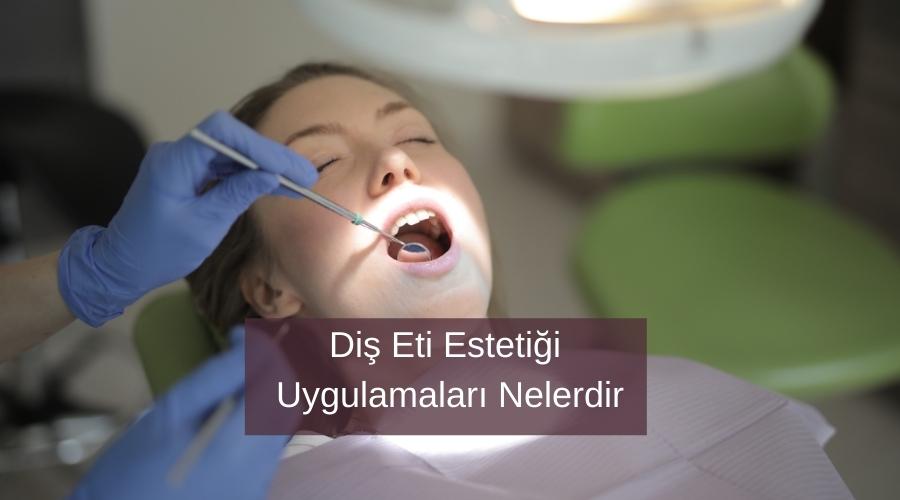 Diş Eti Estetiği Uygulamaları Nelerdir