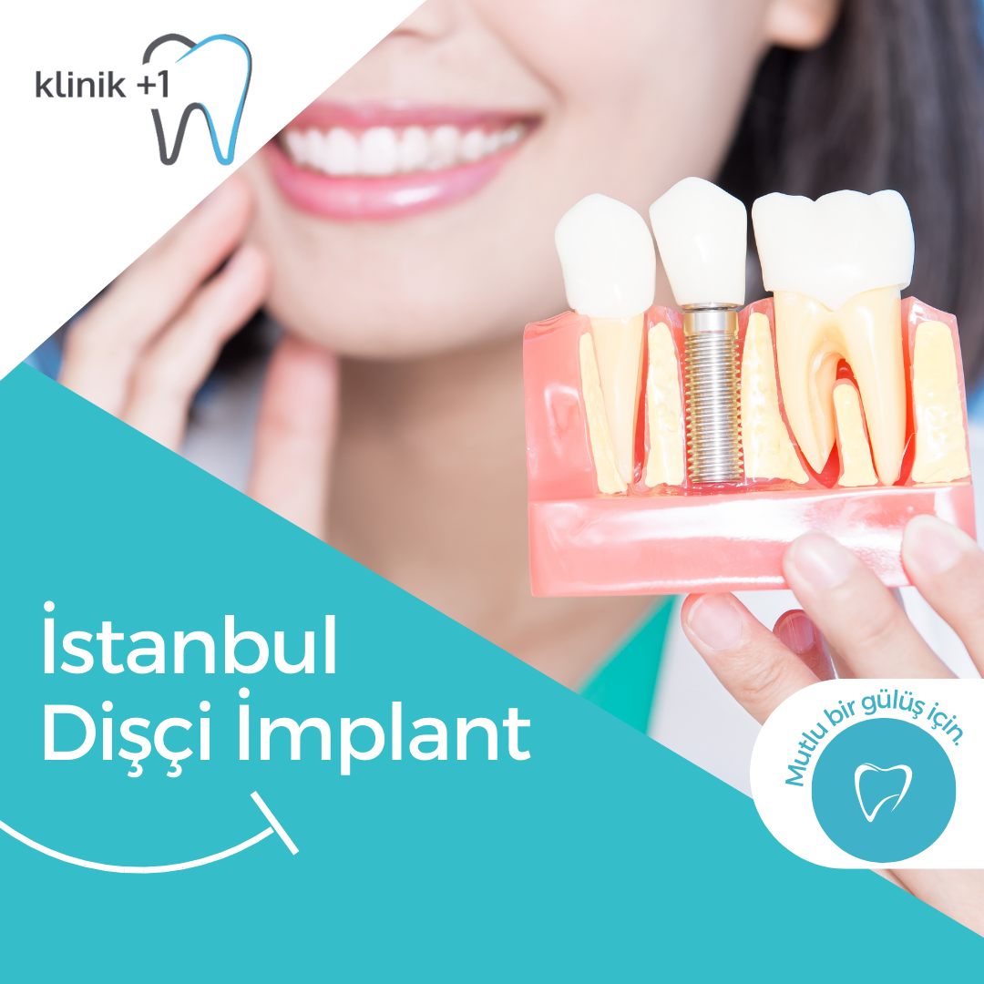 İstanbul dişçi implant