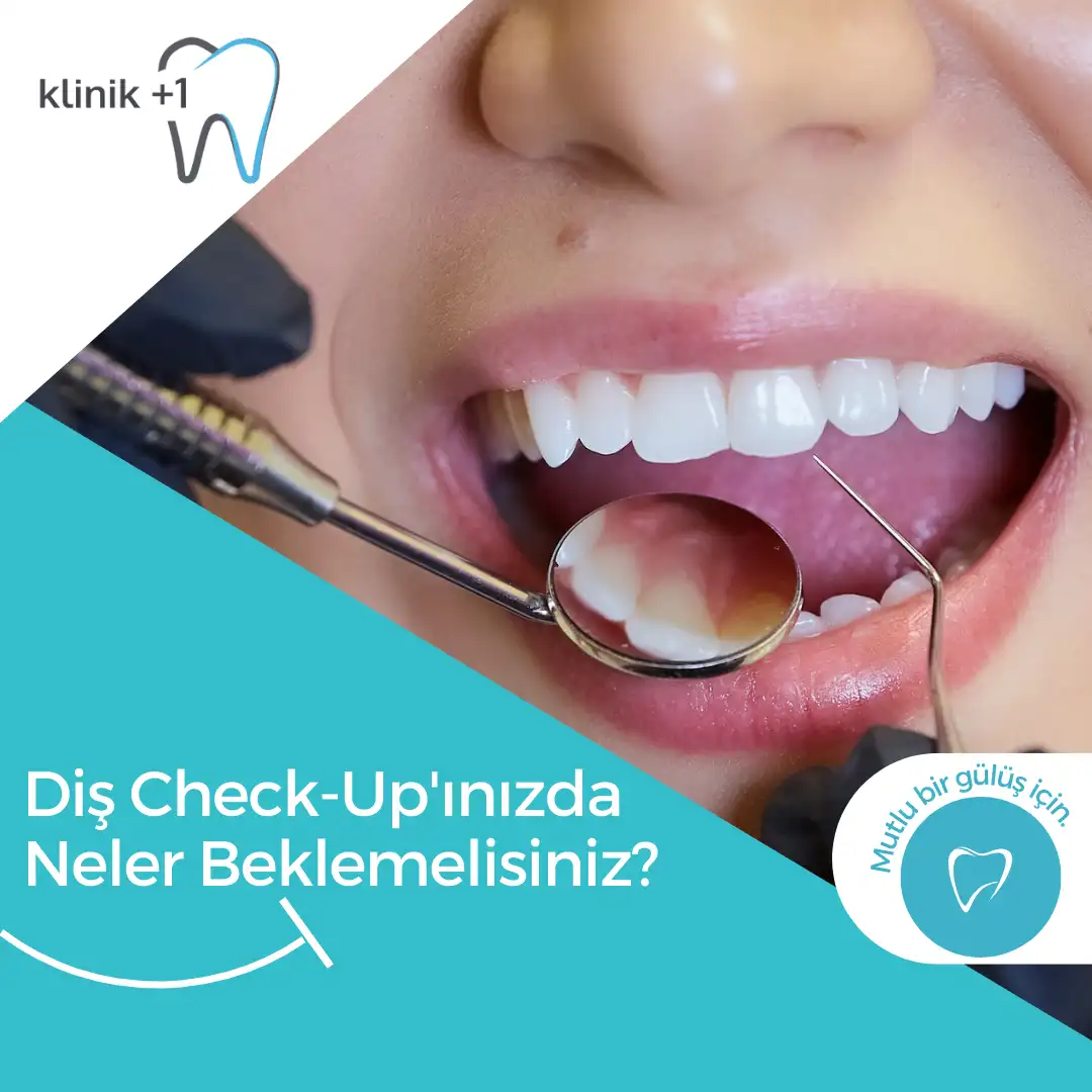 Diş Check-Up'ınızda Neler Beklemelisiniz