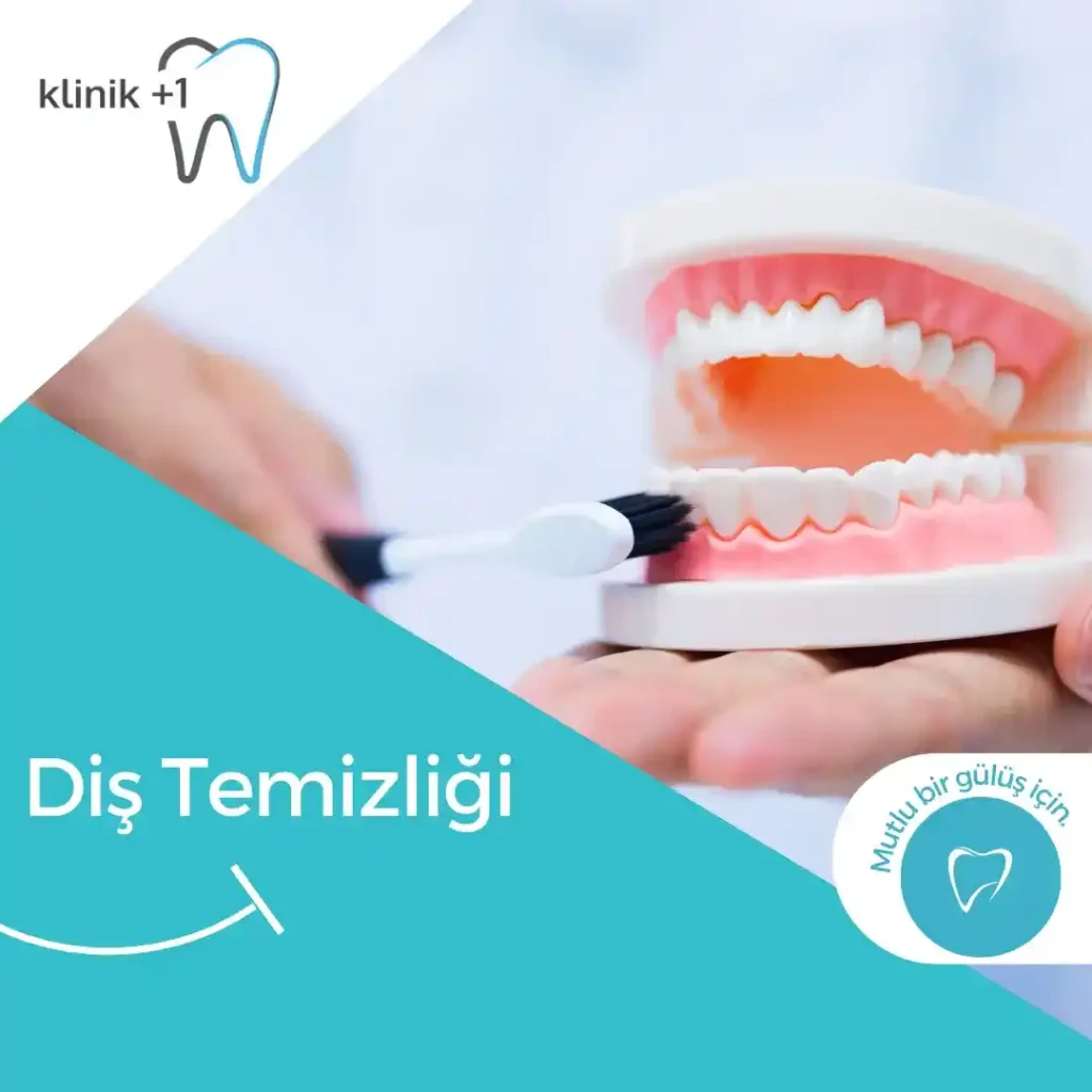 Diş Temizliği 7 Diş Temizliği
