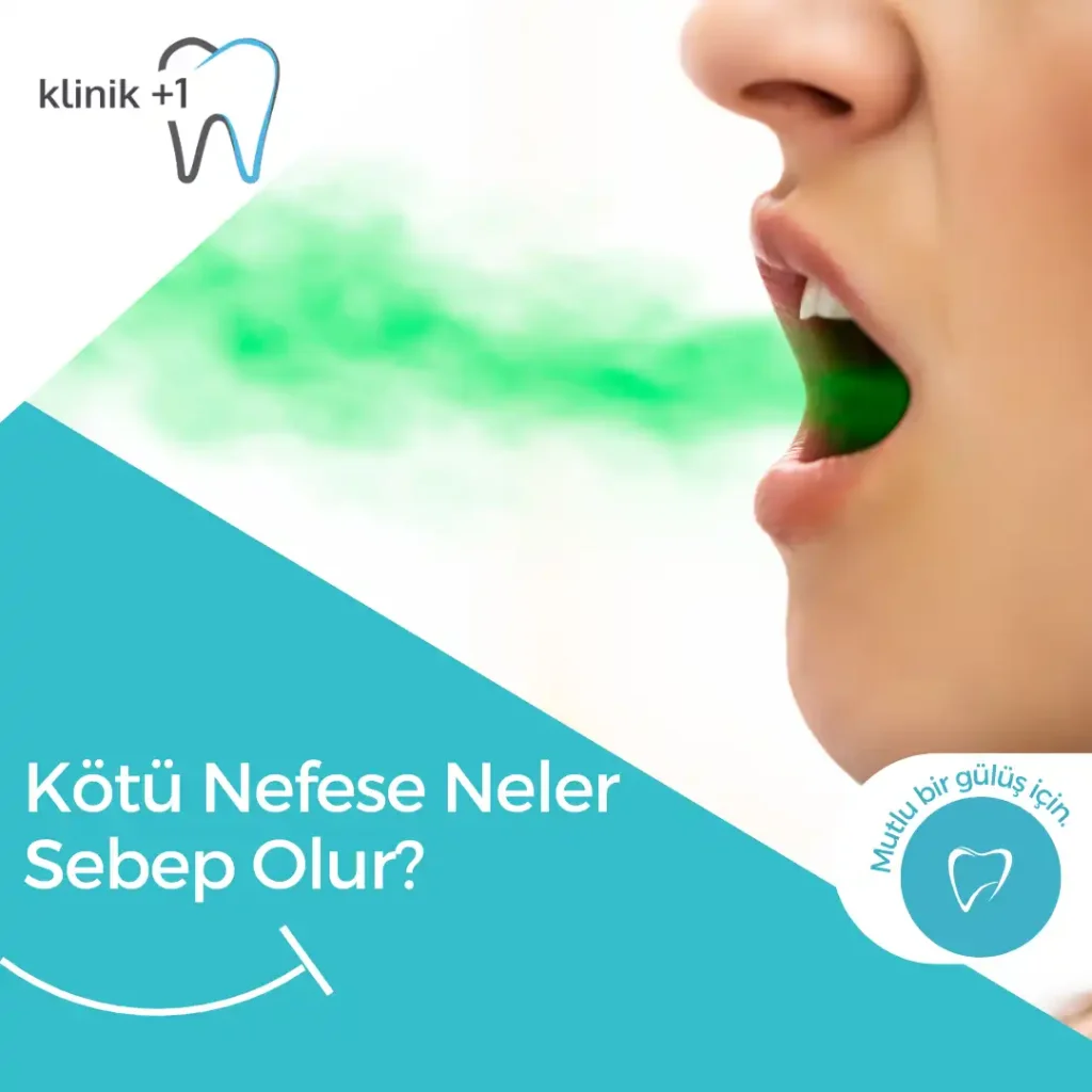 Kötü Nefese Neler Sebep Olur? 9 Kötü Nefese Neler Sebep Olur