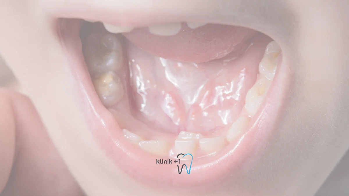 Azi Disi Cikarken Ne Yapmali