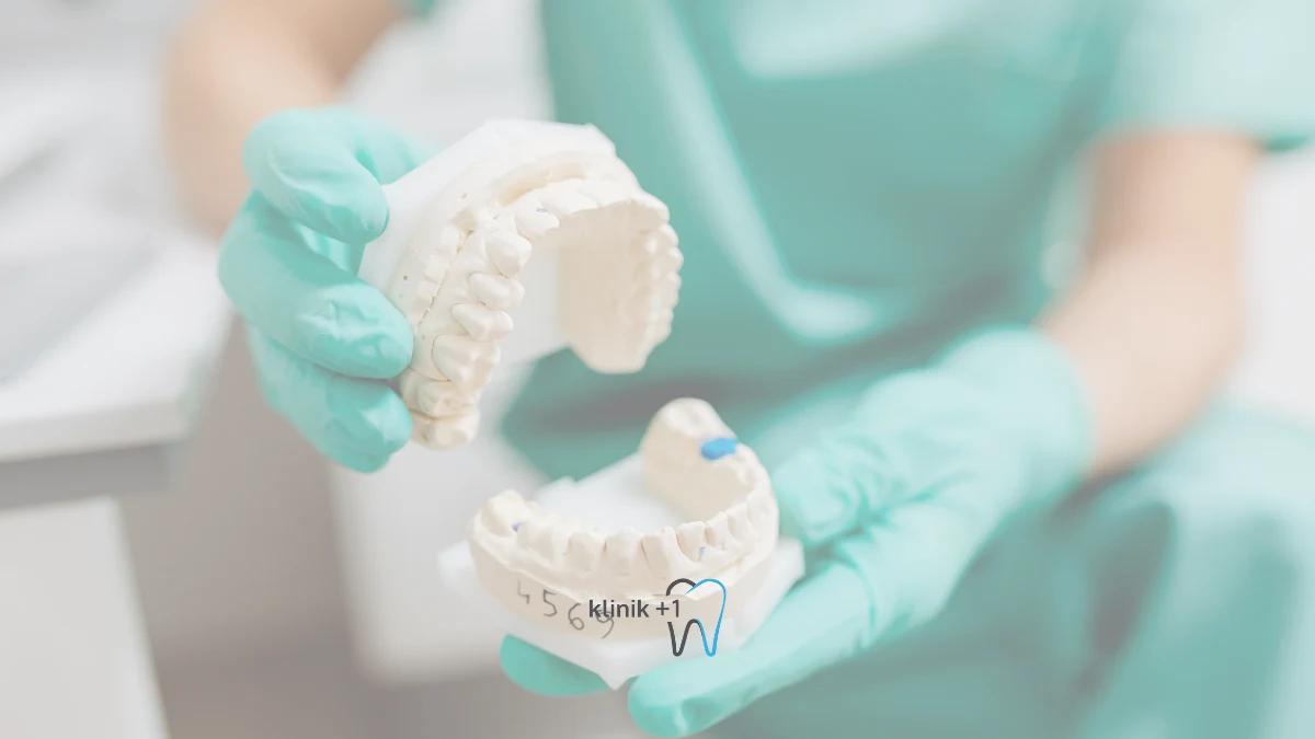 Overbite Dis Kapanis Bozuklugu Nedir